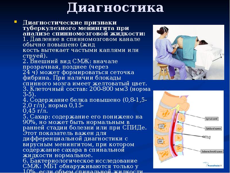 Туберкулезді менингит презентация