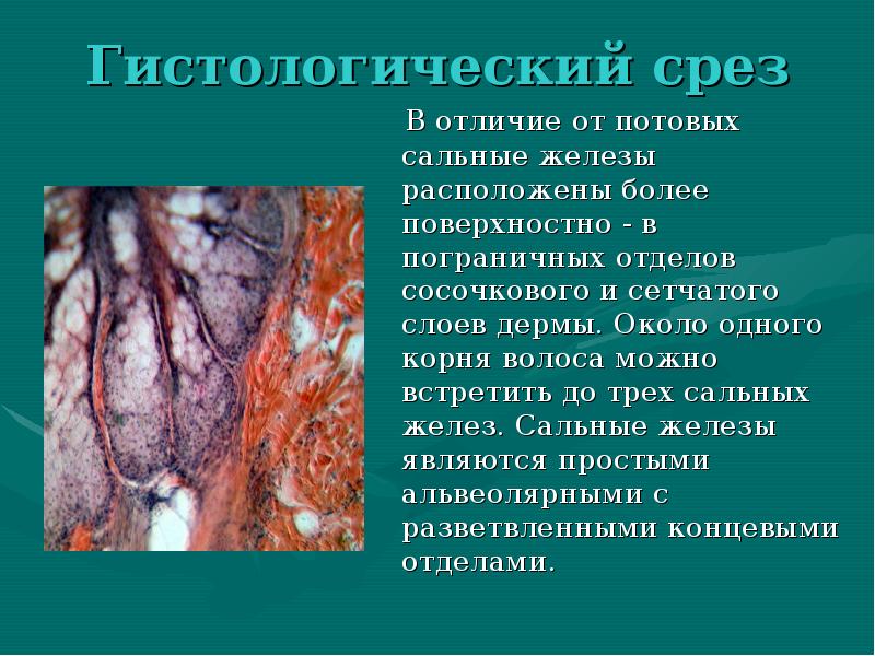 Гистологический срез
В отличие от потовых сальные железы расположены Гистологический срез
В отличие от потовых сальные железы расположены