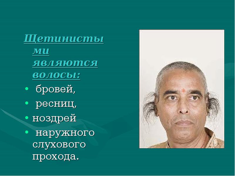 Щетинистыми являются волосы:
Щетинистыми являются волосы:
бровей,
ресниц,
Щетинистыми являются волосы:
Щетинистыми являются волосы:
бровей,
ресниц,