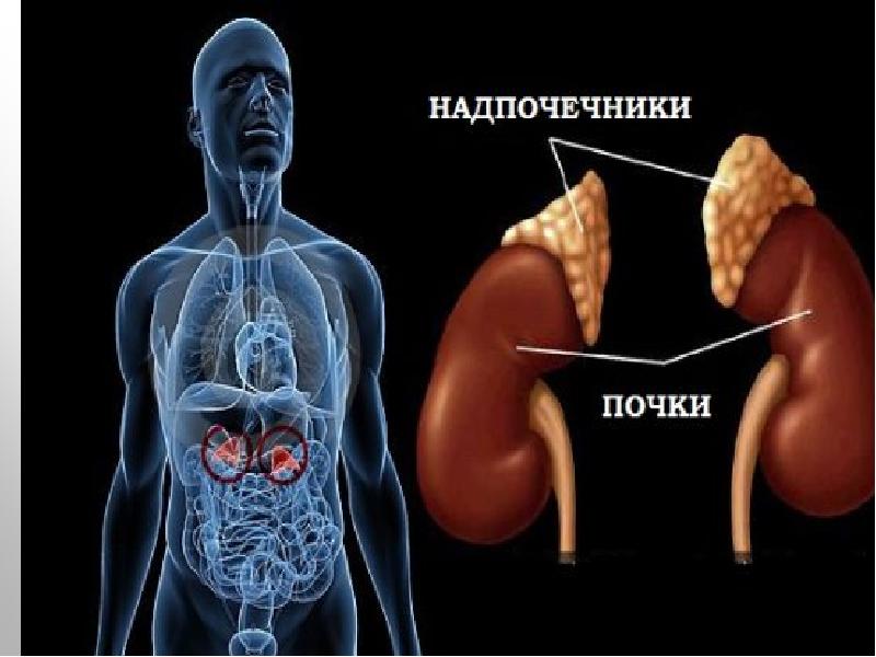 Несахарный диабет презентация эндокринология