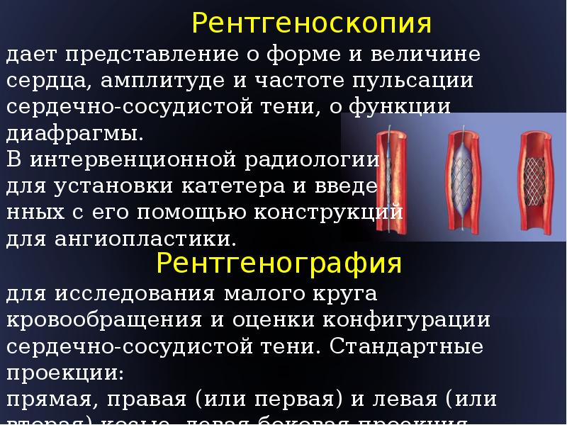 Методы лучевого исследования сердца и сосудов презентация