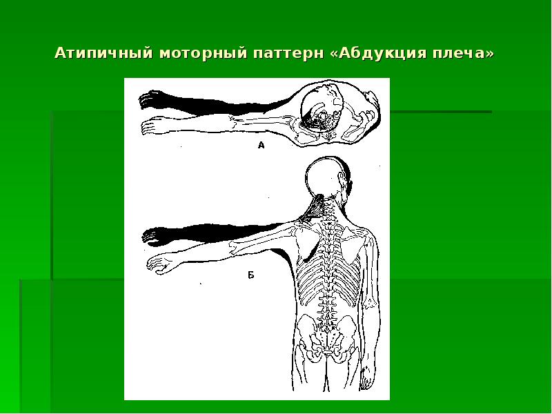 Абдукция. Визуальная диагностика. Визуальная диагностика картинки. Визуальная диагностика 13-16.12.2007.