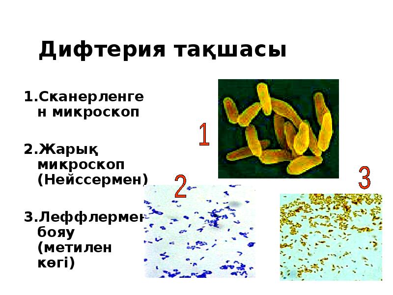 Дифтерия қазақша презентация