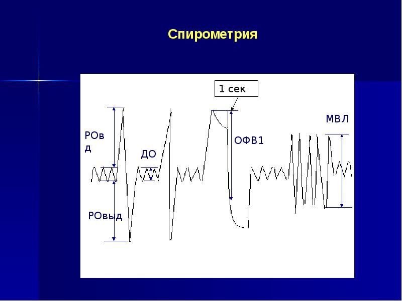 Что дает спирограмма. Спирометрия. ЭКГ спирометрия. МВЛ спирометрия. Спирометрия фото.