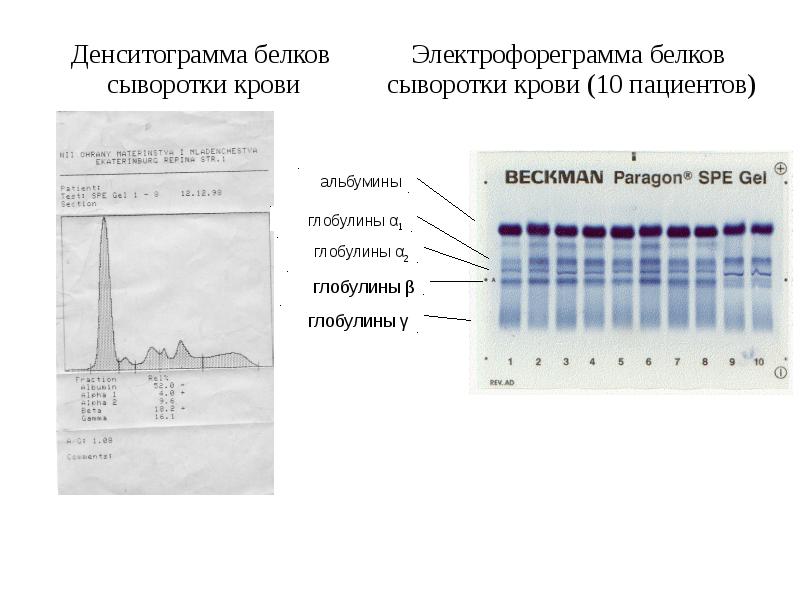 Направление на электрофорез образец