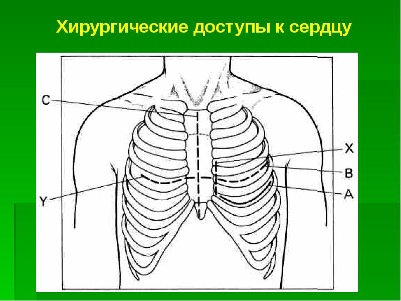 Чирей на грудной железе фото