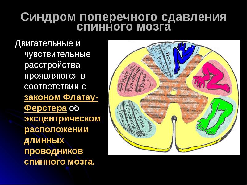 Синдром мозга