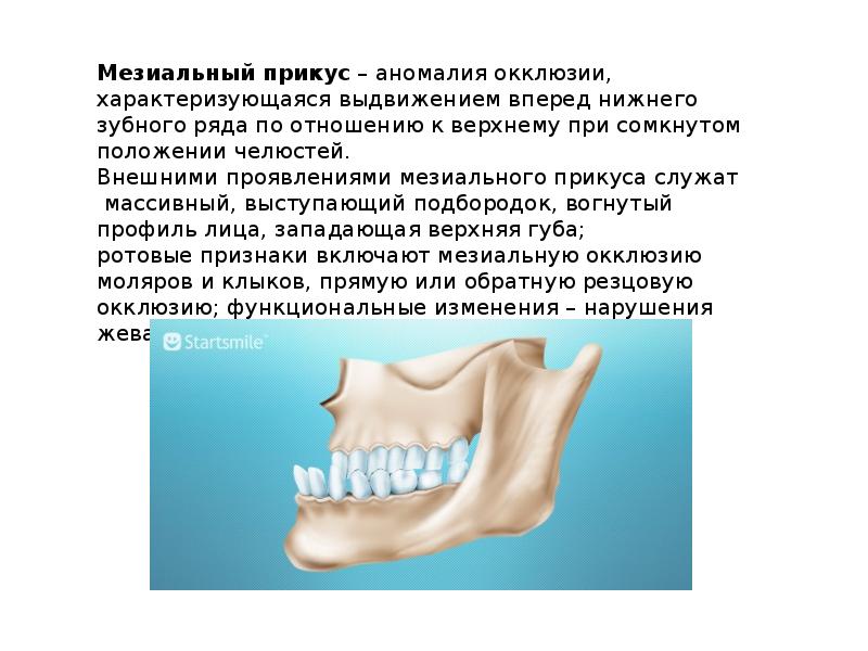 Виды прикусов презентация