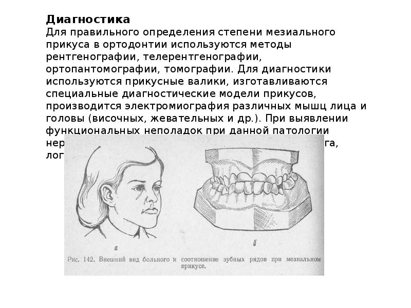 Мезиальная окклюзия презентация