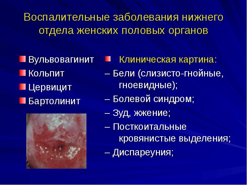 Воспаление женских органов презентация