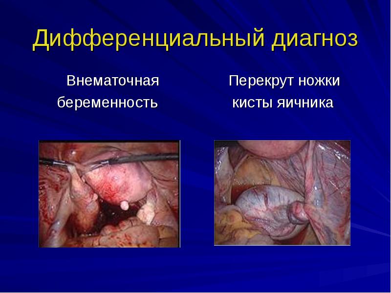 Воспаление женских органов презентация