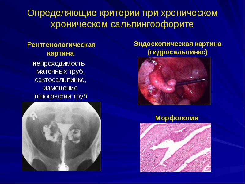 Воспаление женских органов презентация