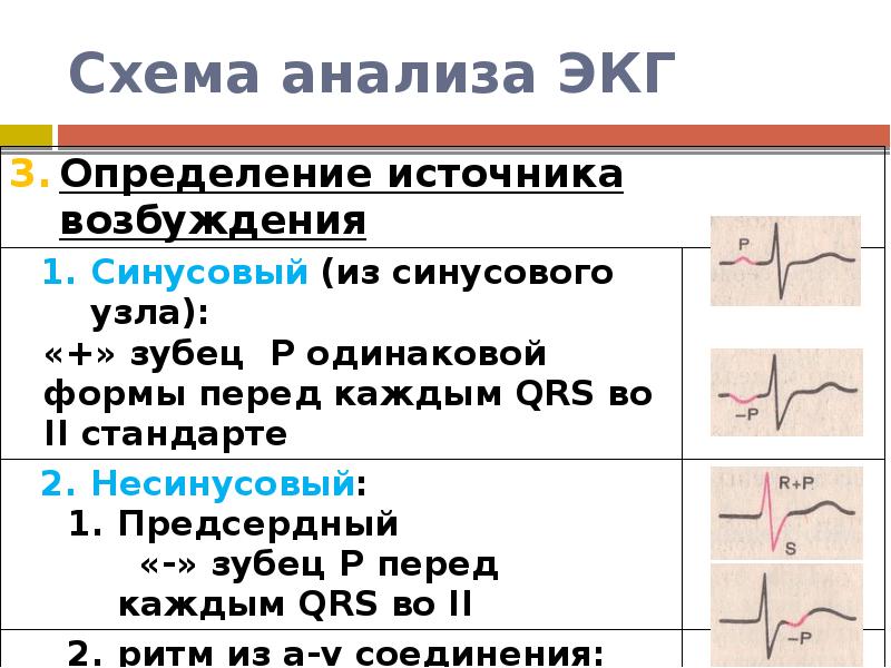 Анализ экг