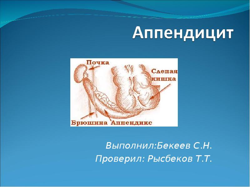 Скачать презентацию на тему острый аппендицит