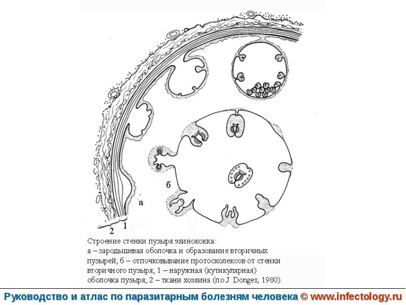 Стенка пузыря. Эхинококкоз строение пузыря. Строение кисты эхинококка. Эхинококковая киста строение. Эхинококк пузырь строение.