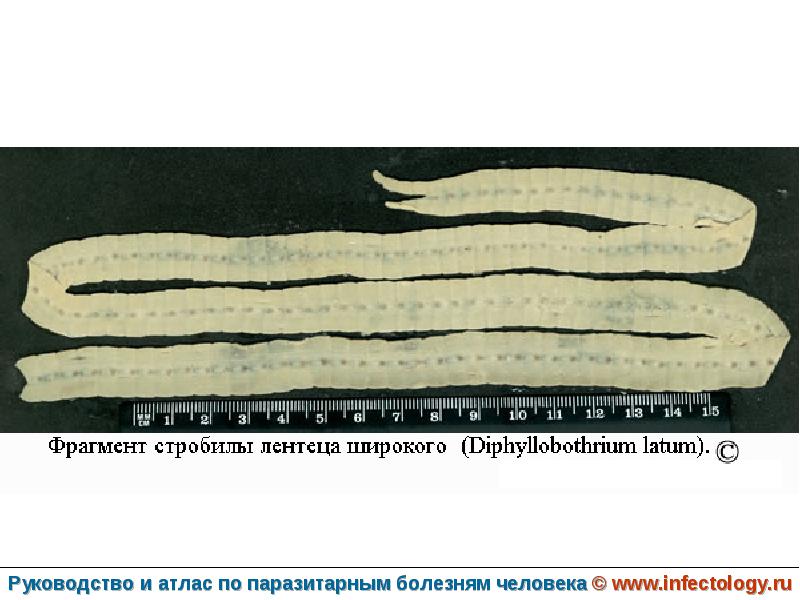 Широкого лентеца. Фрагмент стробилы лентеца широкого. Широкий лентец (Diphyllobothrium latum). Цестодозы дифиллоботриоз. Широкий лентец стробила.