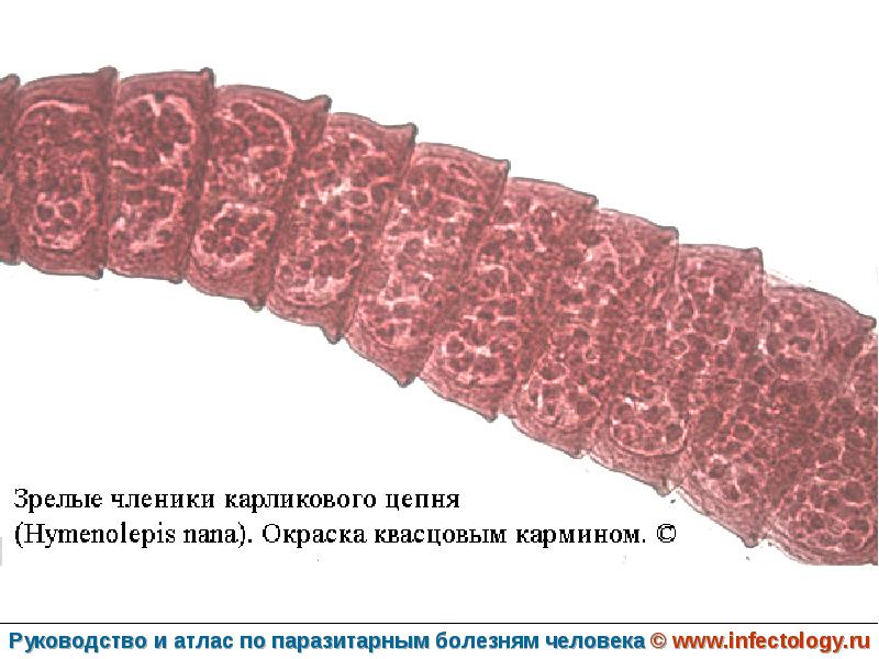 Карликовый цепень строение. Hymenolepis Nana – карликовый цепень-гименолепидоз. Строение членика карликового цепня. Карликовый цепень проглоттиды. Бычий свиной и карликовый цепень.