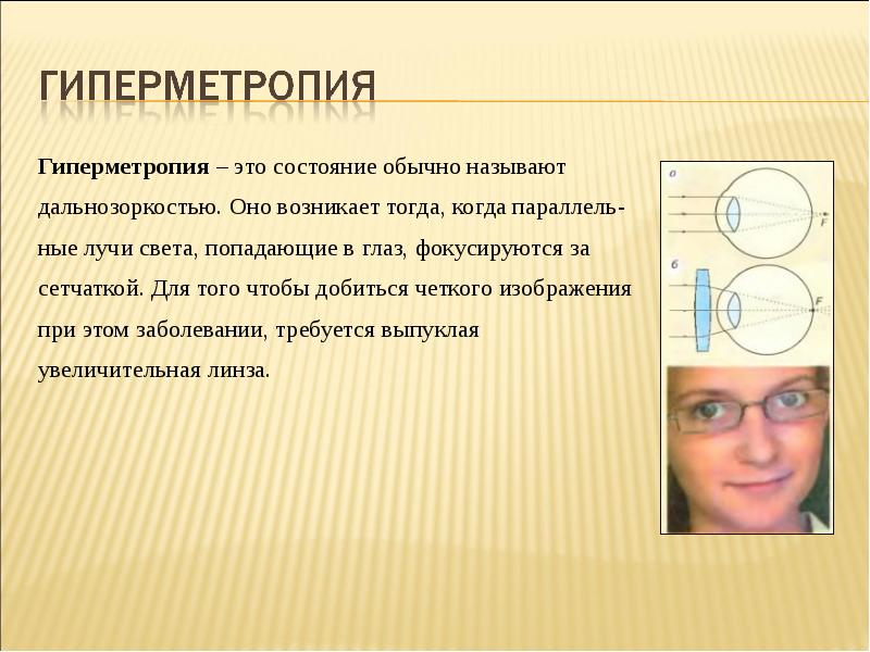 Как обычно называют. Гиперметропия 2 степени. Гиперметропия жалобы. Гиперметропия презентация. Гиперметропия 1 степени что это такое.