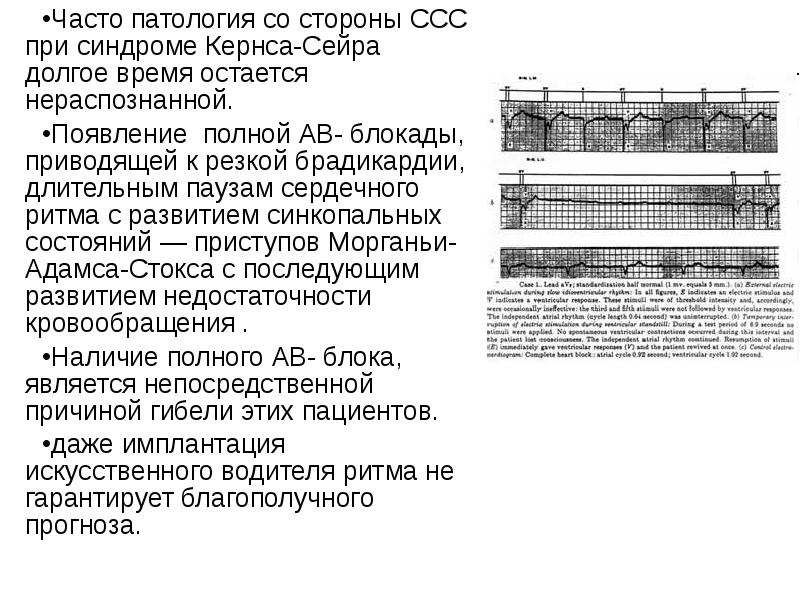 Митохондриальные заболевания презентация