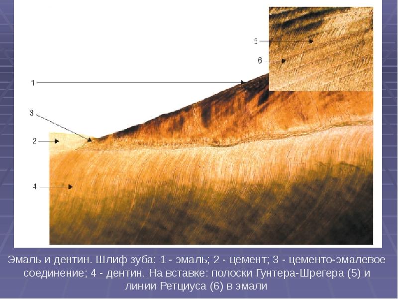 Презентация лечение кариеса молочных зубов