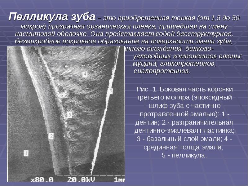 Презентация лечение кариеса молочных зубов