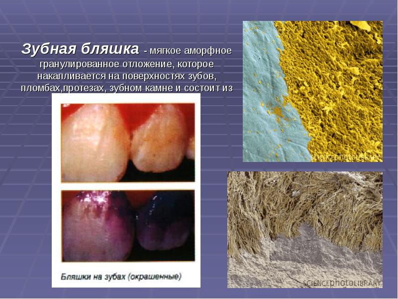 Презентация лечение кариеса молочных зубов