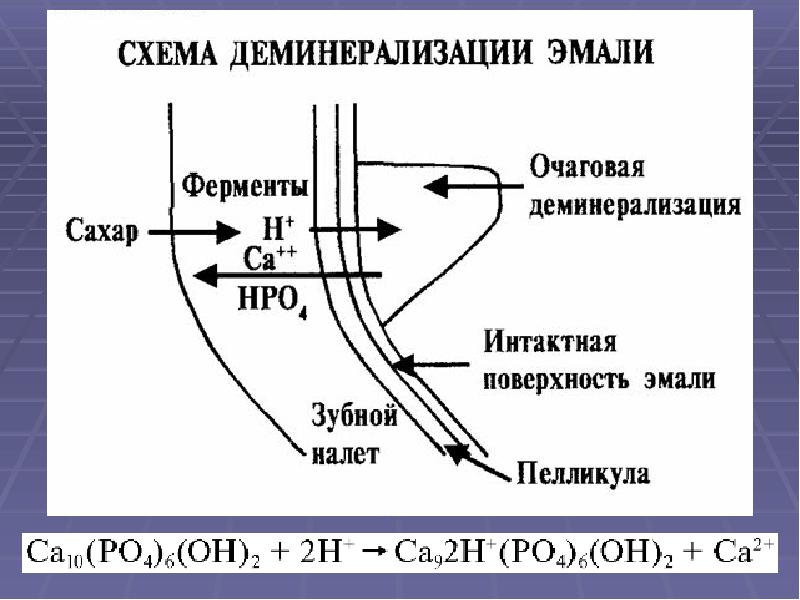 Презентация лечение кариеса молочных зубов