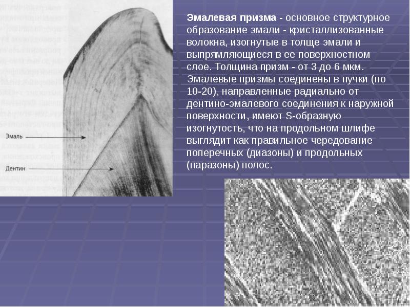 Презентация лечение кариеса молочных зубов