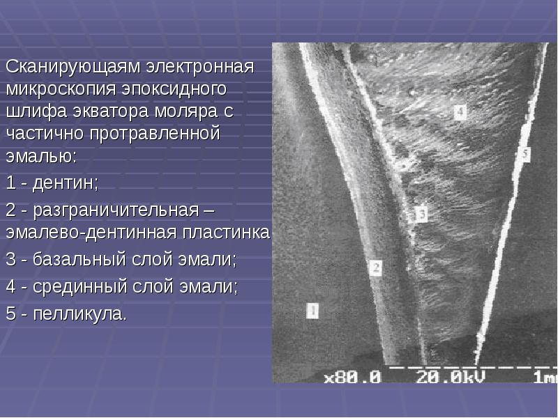 Презентация лечение кариеса молочных зубов