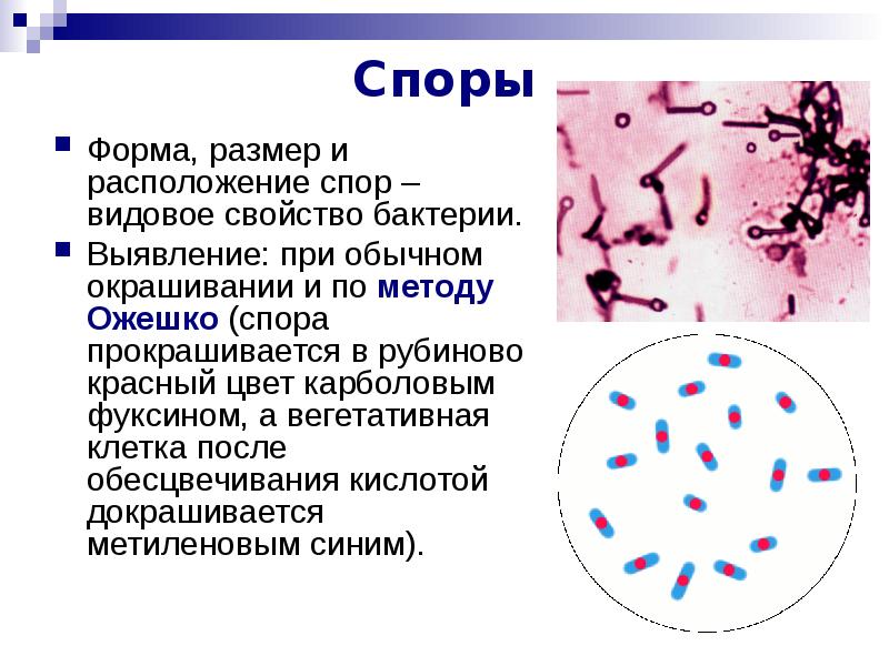 Формы спора. Метод окраски по Ожешко микробиология. Метод выявления спор у бактерий. Методы окраски бактерий по Ожешко. Окраска по методу Ожешко микробиология.