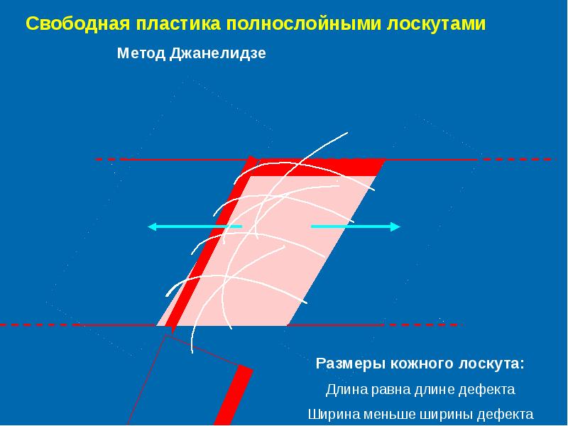 Свободная кожная пластика