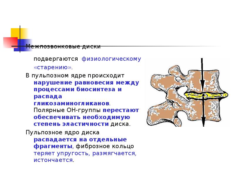 Дегидратации дисков что это. Дегидратация пульпозного ядра. Дегидратация межпозвонковых дисков. Пульпозное ядро межпозвоночного диска. Дегидратация диска на мрт.