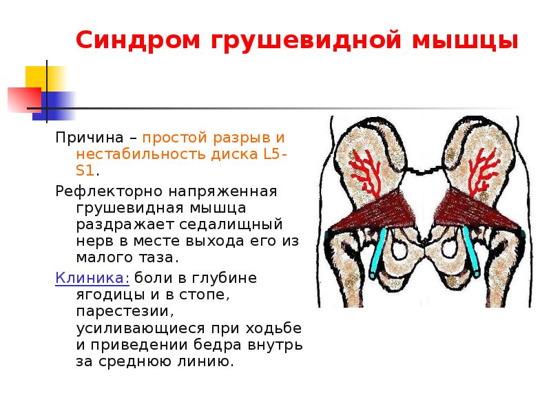 Схема грушевидной мышцы