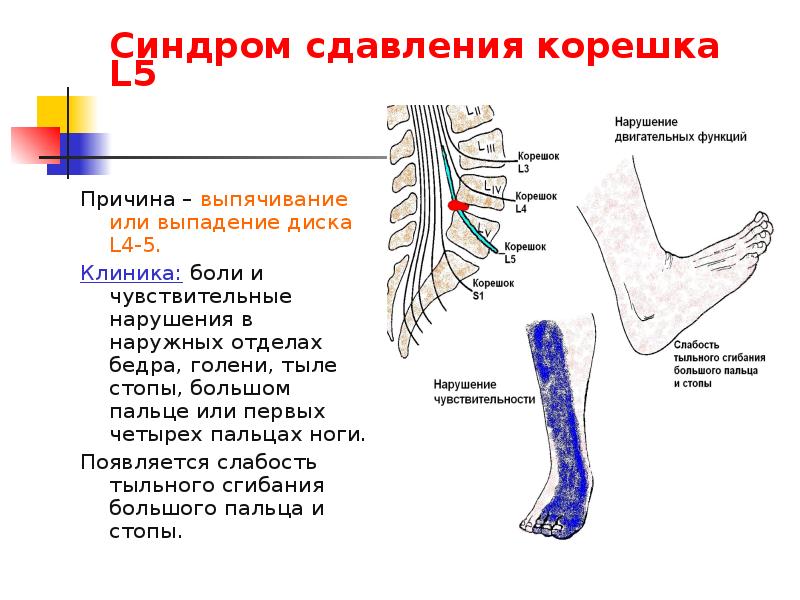 Описание корешка