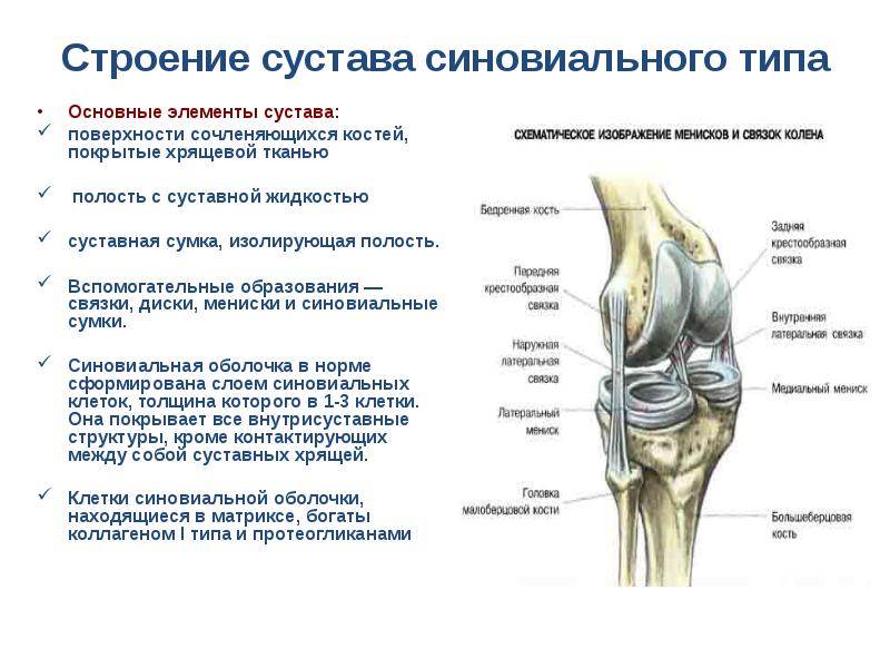 Презентация на тему артрозы