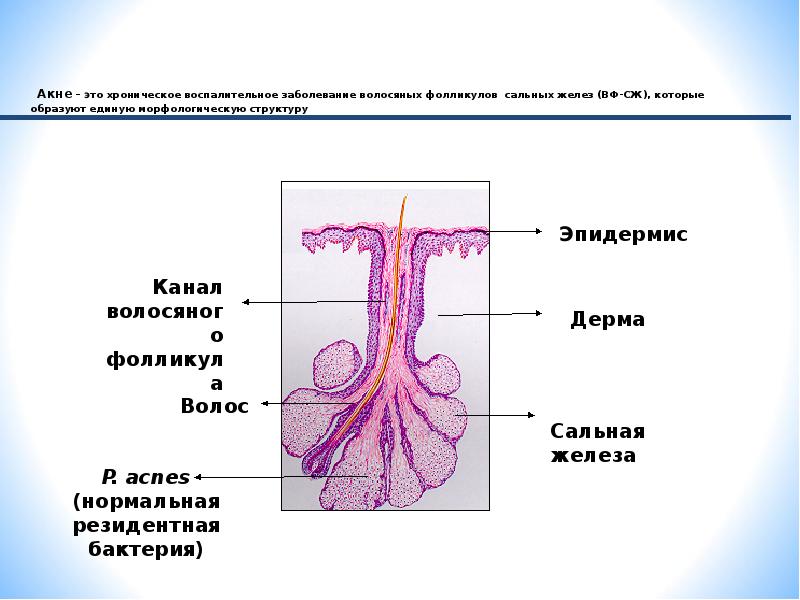 Сальная железа на рисунке