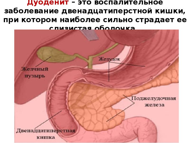 Заболевания органов мочевыделения презентация 8 класс пасечник