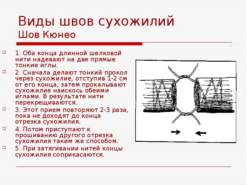 Виды хирургических швов презентация