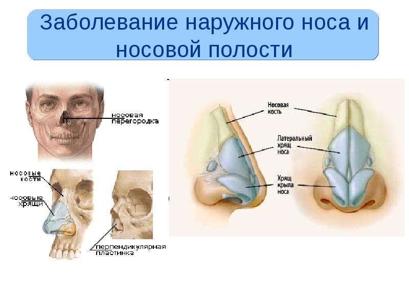 Картинки заболеваний носа