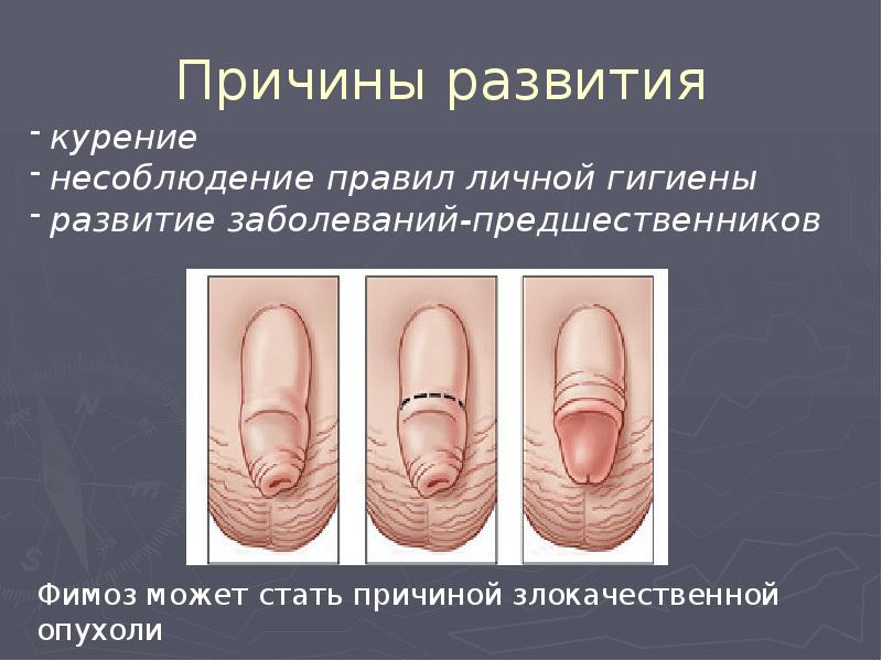 Причины развития Причины развития