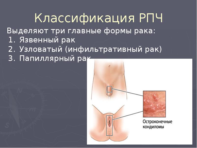 Классификация РПЧ Классификация РПЧ