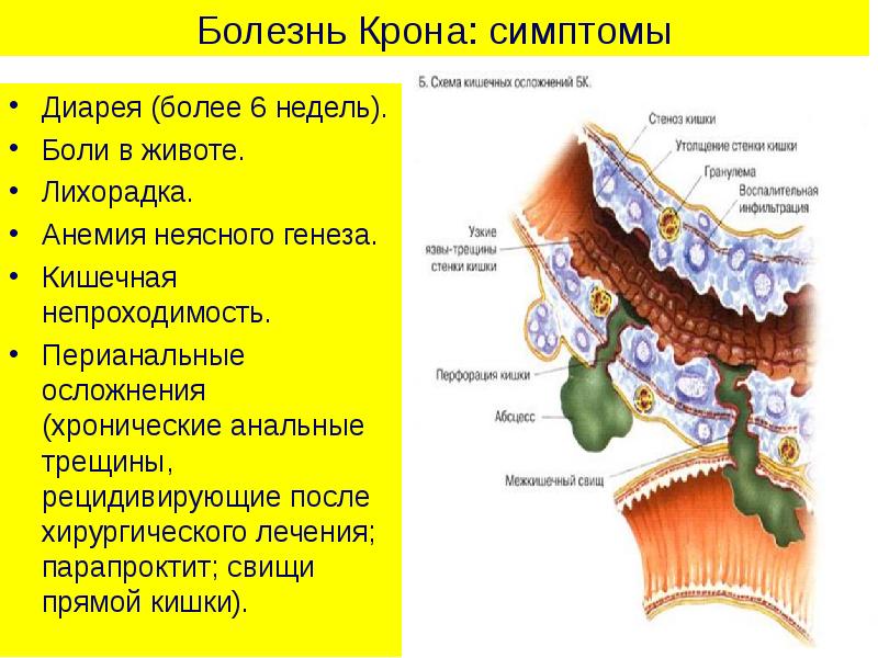 Орфанные заболевания презентация