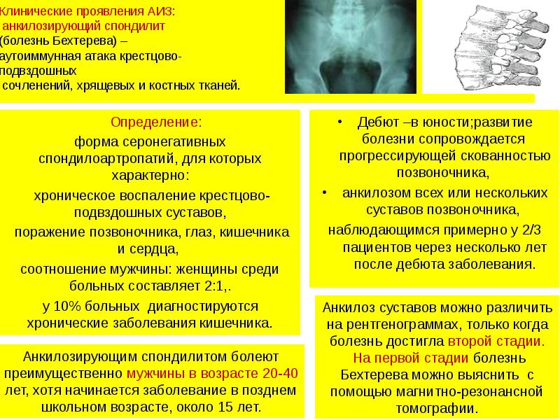 Аутоиммунные заболевания презентация