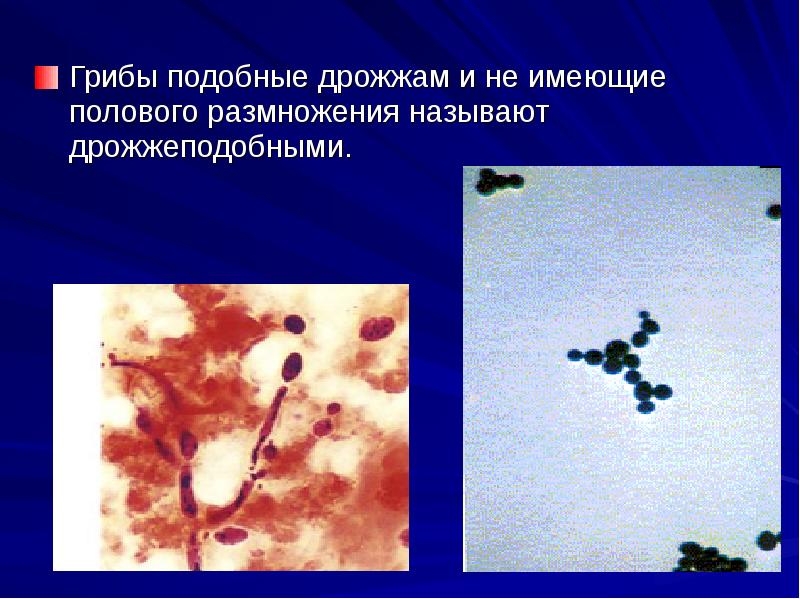 Микроскопические грибы презентация