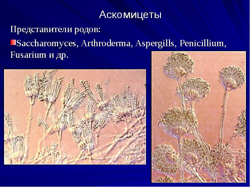 Аскомицеты
Представители родов:
Saccharomyces, Arthroderma, Aspergills, Penicillium, Fusarium и др. Аскомицеты
Представители родов:
Saccharomyces, Arthroderma, Aspergills, Penicillium, Fusarium и др.