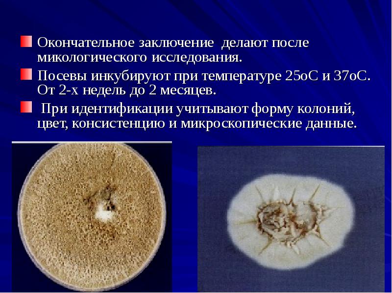 Окончательное заключение делают после микологического исследования.
Посевы инкубируют при температуре 25оС Окончательное заключение делают после микологического исследования.
Посевы инкубируют при температуре 25оС