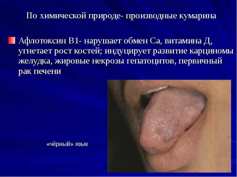 По химической природе- производные кумарина
По химической природе- производные кумарина
Афлотоксин По химической природе- производные кумарина
По химической природе- производные кумарина
Афлотоксин