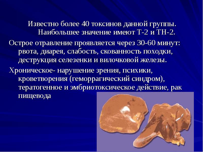 Известно более 40 токсинов данной группы. Наибольшее значение имеют Т-2 и Известно более 40 токсинов данной группы. Наибольшее значение имеют Т-2 и