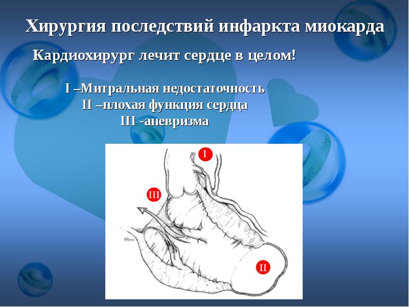 Осложнения инфаркта миокарда презентация