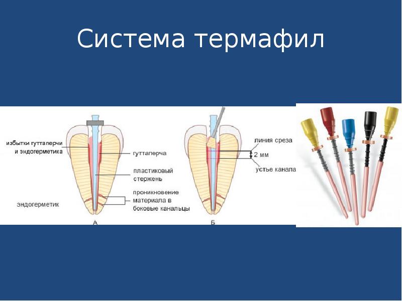 Эндодонтические аксессуары презентация